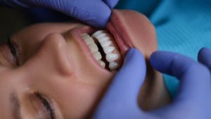 How To Whiten Dentures stain removal